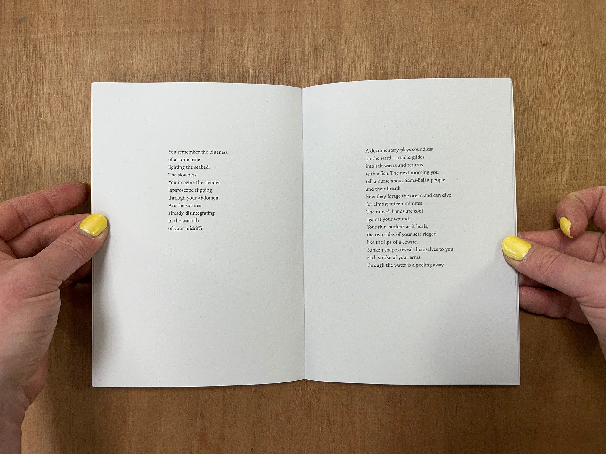 SPLENECTOMY by Eloise Birtwhistle