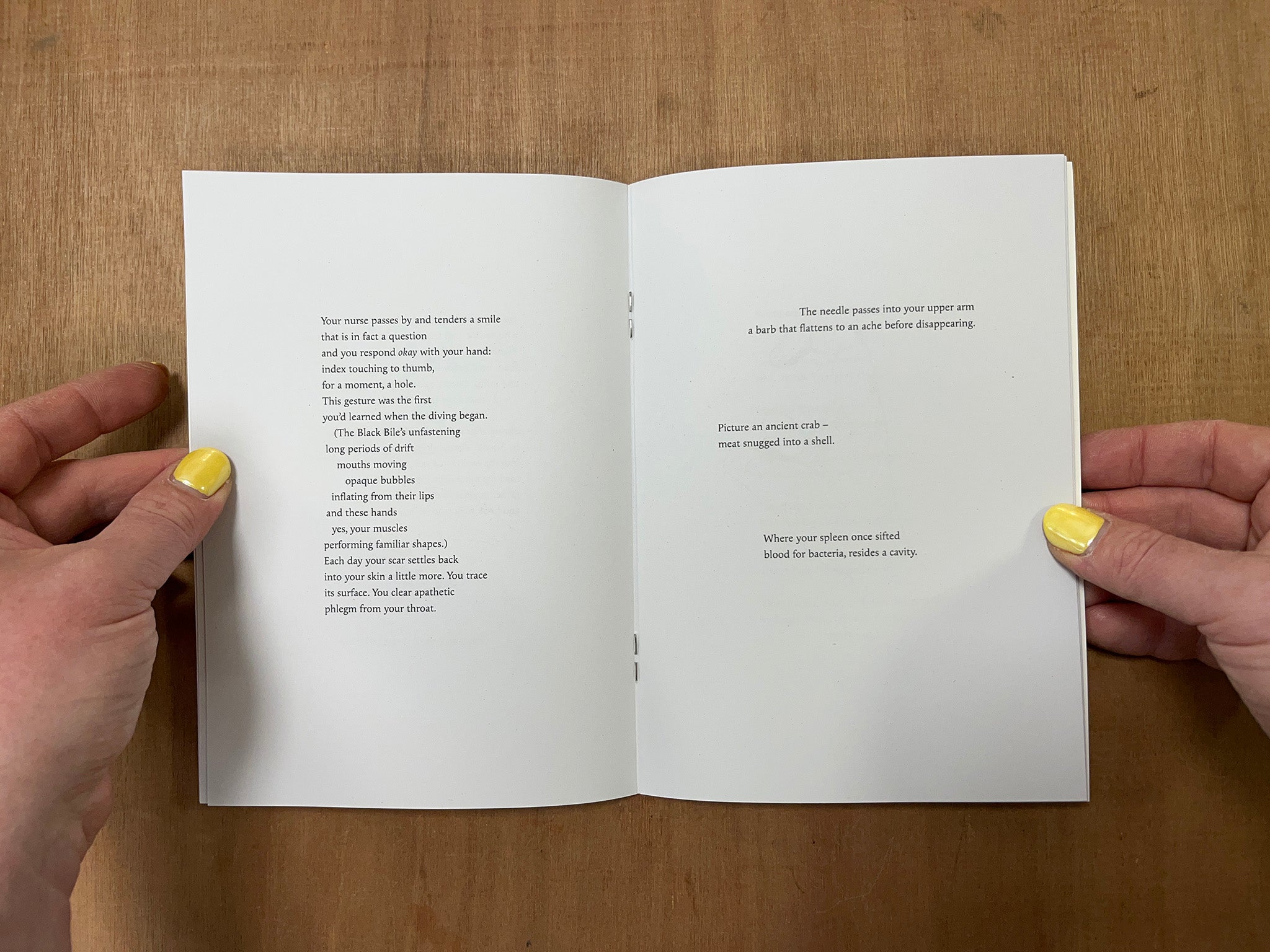 SPLENECTOMY by Eloise Birtwhistle